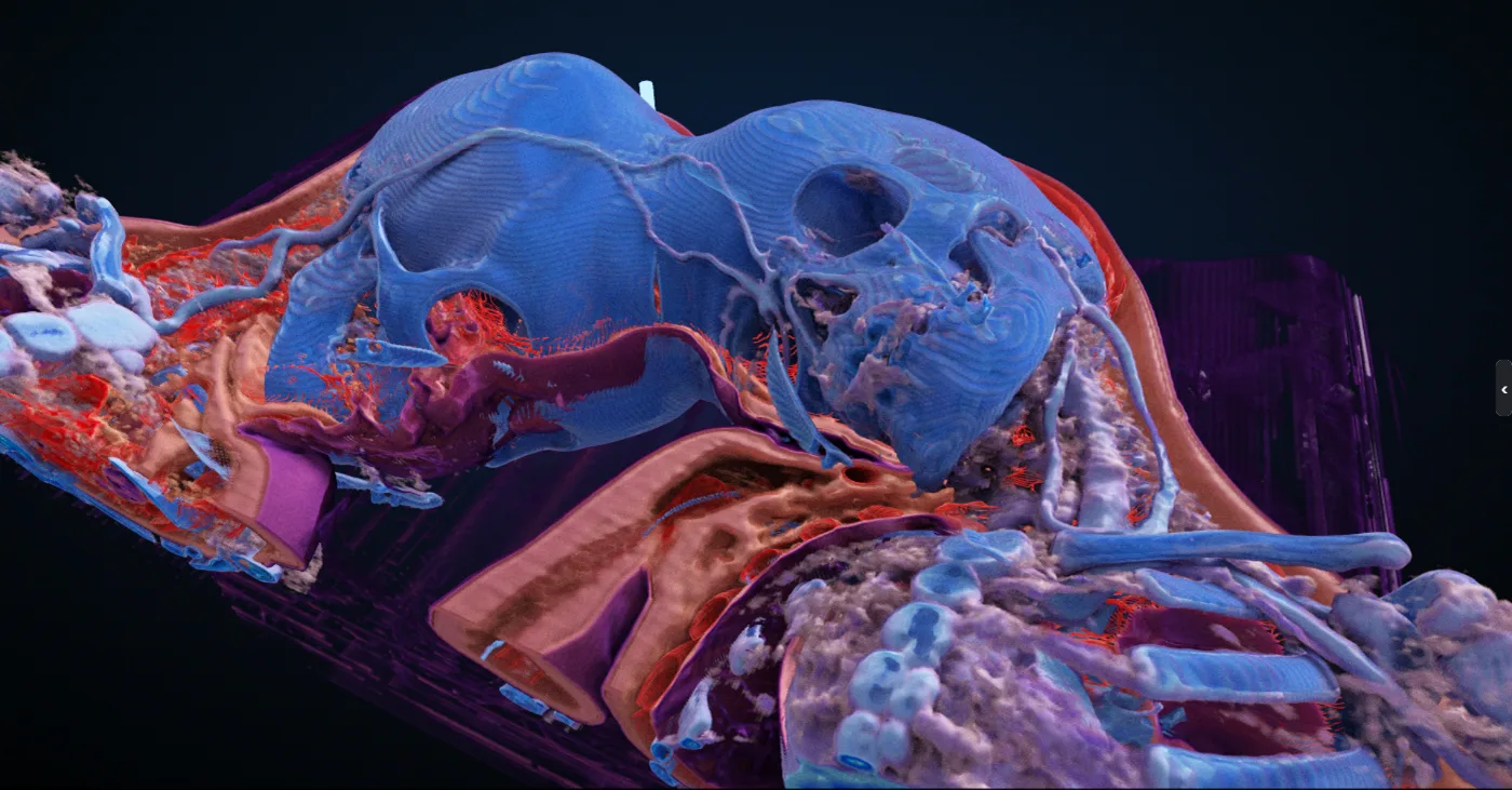 Volume rendering of a pediatric MR study
