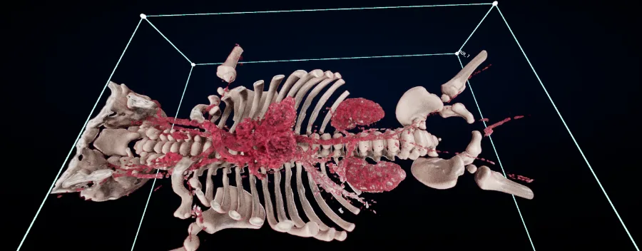 Skeleton with vessels